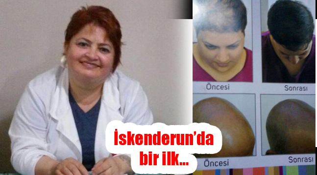 SİTE ICIN